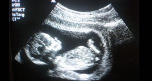 ecografia-ultrasuoni